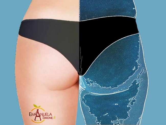 cellulite_rgx_emanuela_simone cellulite