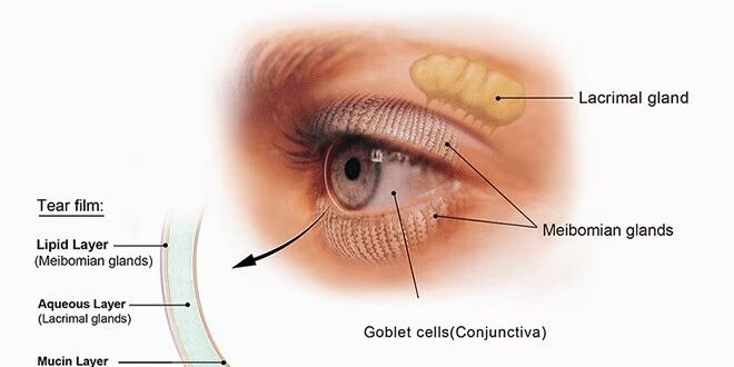 Sindrome occhio secco