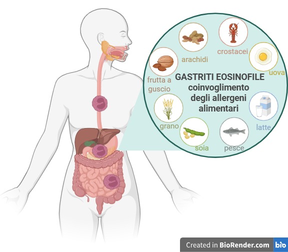 malattie digestive allergeni alimentari
